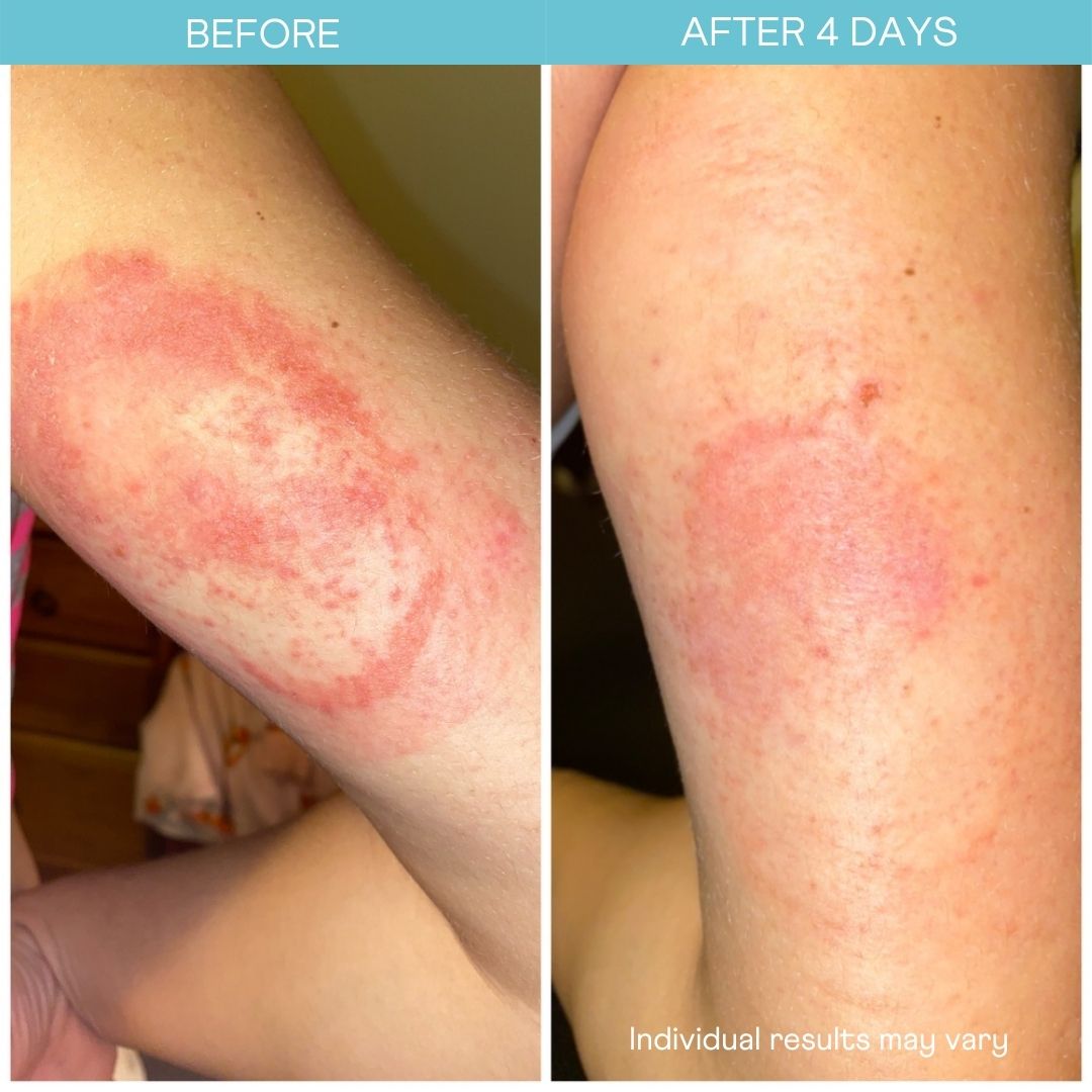 'TLC' Intensive Repair Oil 100ml